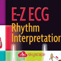 E-Z ECG Rhythm Interpretation