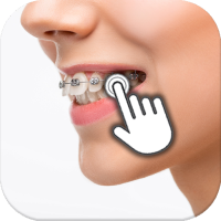 Braces on teeth: Photo editor